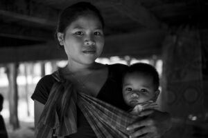 赤ちゃんのとびひの症状と対処法は？